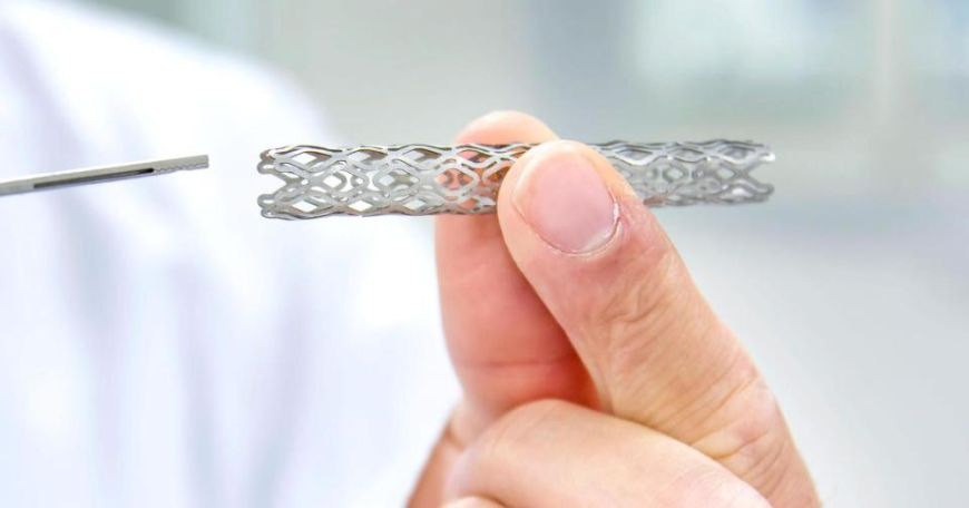 Yurakka stent qo‘yish – bu nima va uning turlari qanday?