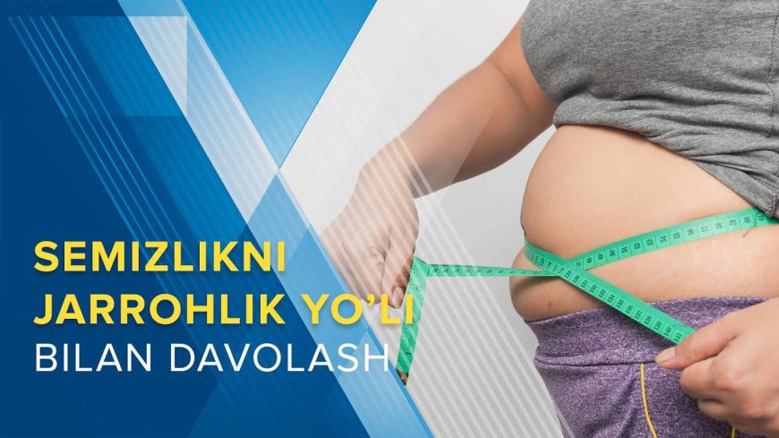 Bariatrik jarrohlik nima? ozish uchun foydalimi?
